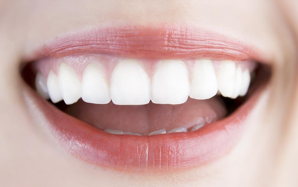 How Can I Get Rid of Yellowish Teeth?